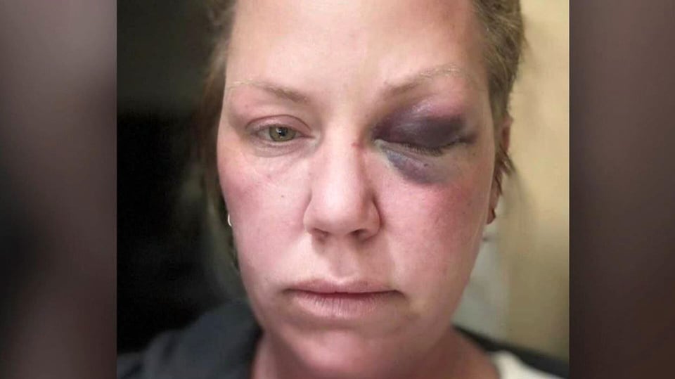 Ontario woman punched in the faced while vacationing in Cuba