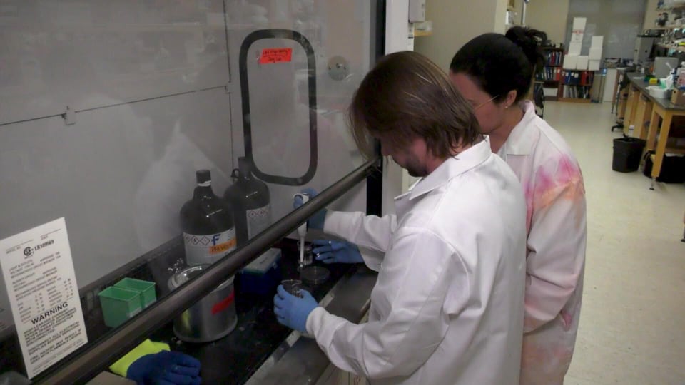Sask. researchers testing milk kefir for potential Alzheimer’s treatment