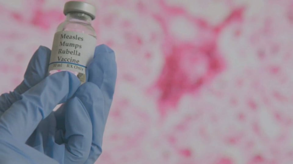 Calgary Board of Education issues measles warning for AHS