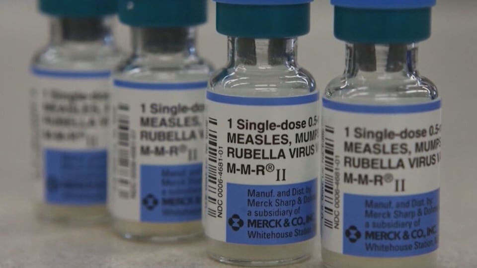 AHS warns of another measles case in southern Alberta